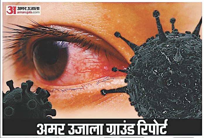 19 New  Black Fungus pateint, 2 discarged
