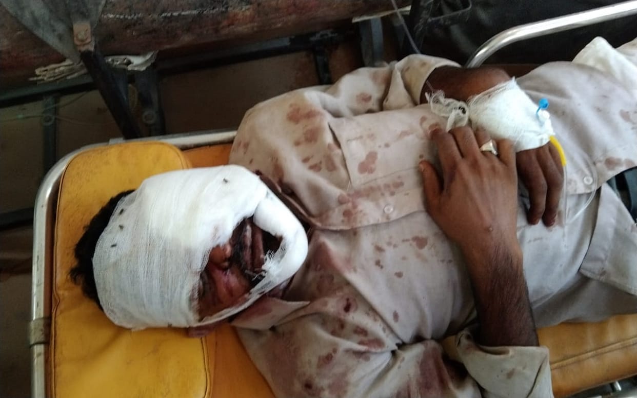group clash and Stone pelting in a dispute over playing DJ music on the eve of Nikah in jaunpur three injured