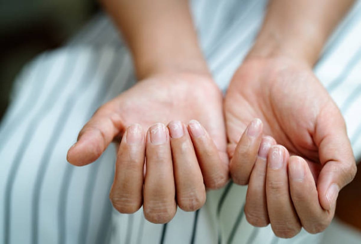 how nails can reveal cancer, all you need to know about this