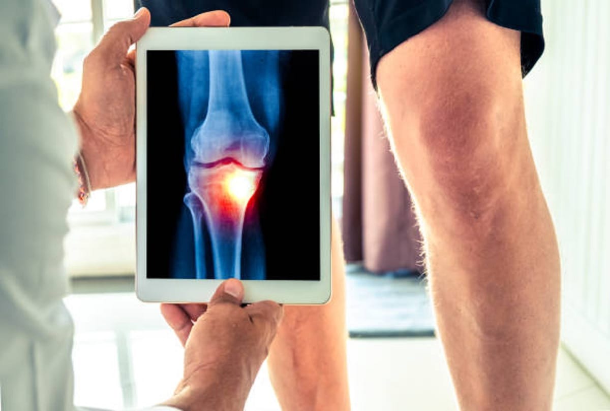 Know How to Heal Fractured Bone Faster in Hindi