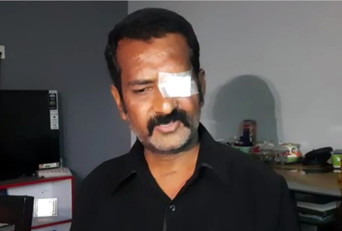 Nagpur 1.5 crore rupees were spent in the treatment of black fungus after all one eye was lost