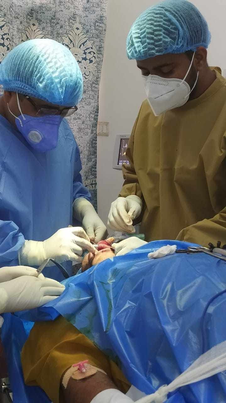 4 patient death of black fungus