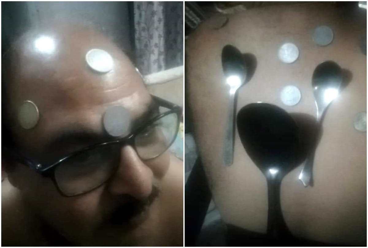 Spoon and coins stick to doctors body after two months of getting vaccinated