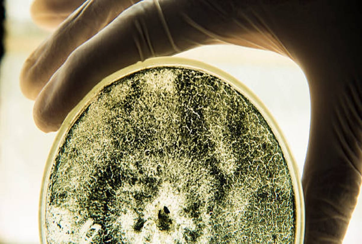 Green fungus in corona patient know the symptoms of Green Fungus infection Aspergillus