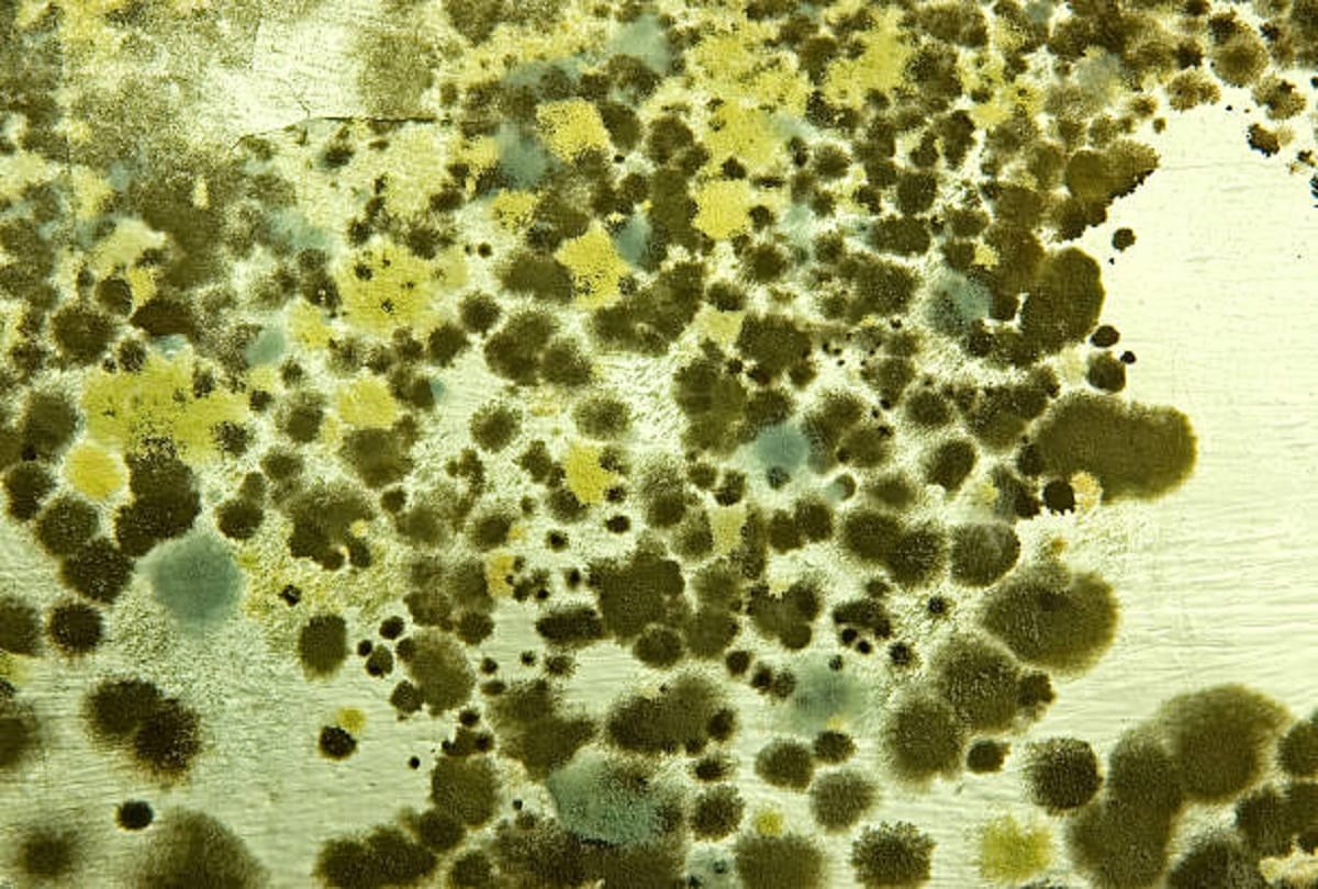 Green fungus in corona patient know the symptoms of Green Fungus infection Aspergillus