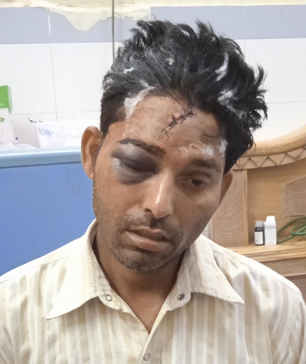 Robbed by entering the house, injuring the young man by hitting him with a baria