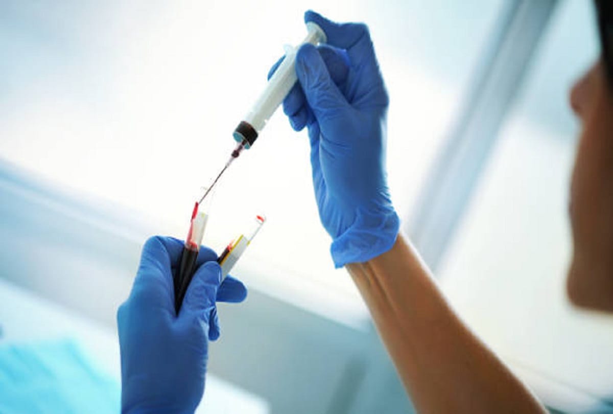 Cholesterol And Health: Know More About Right Level