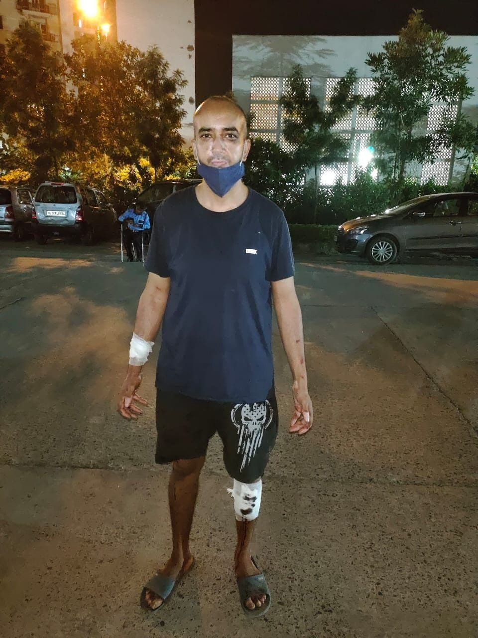 Father-son beat up young man walking pet dogs