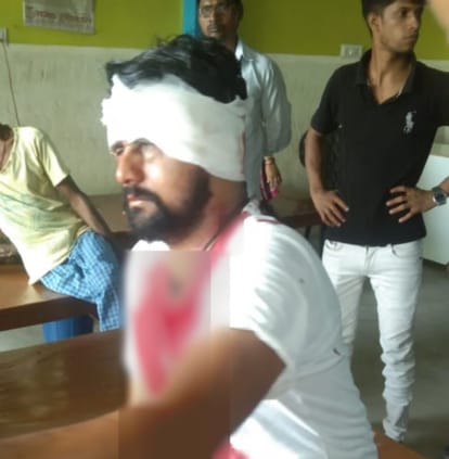 Firing on youth bullet passed by his near head crook ran away by Scorpio in varanasi