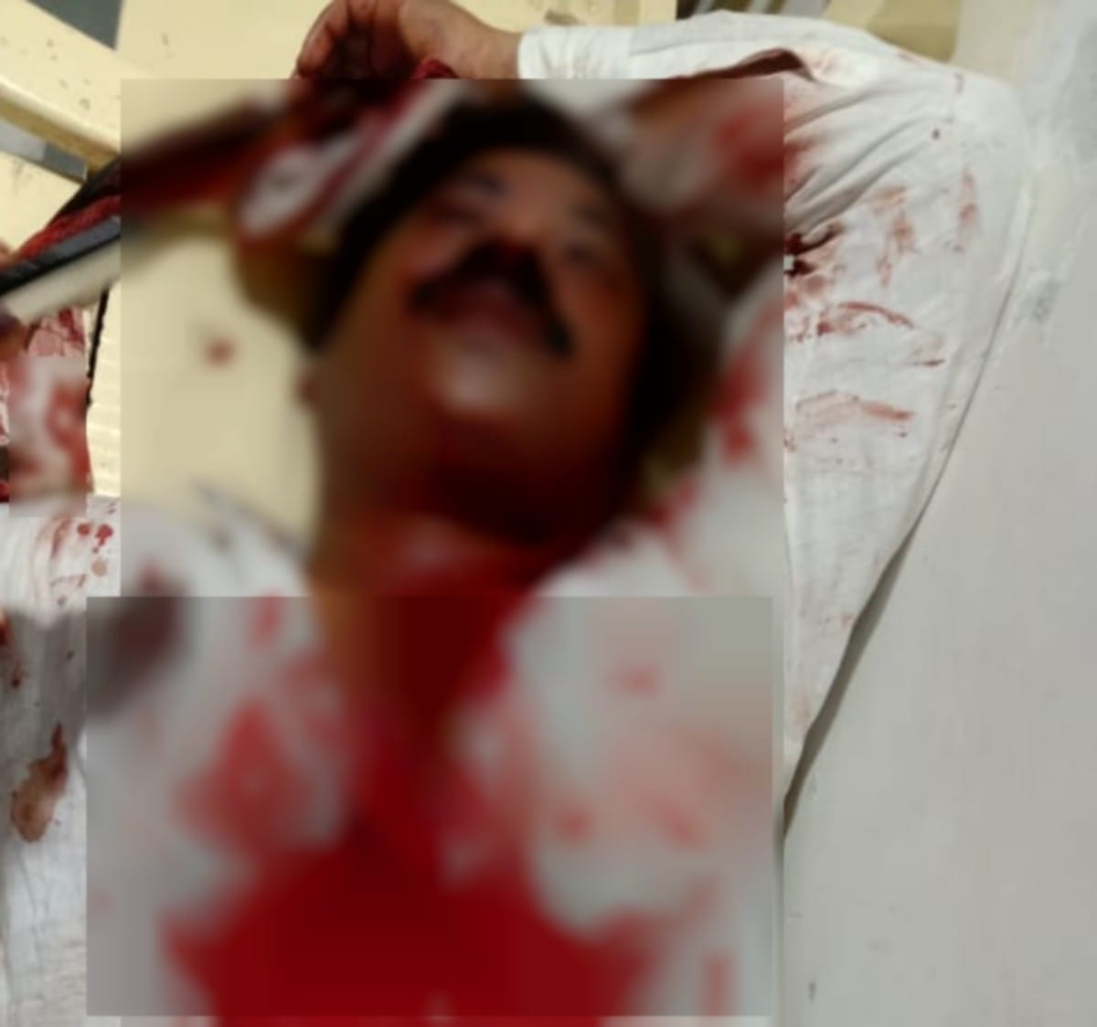 People beaten a man brutally admitted trauma center in chandauli