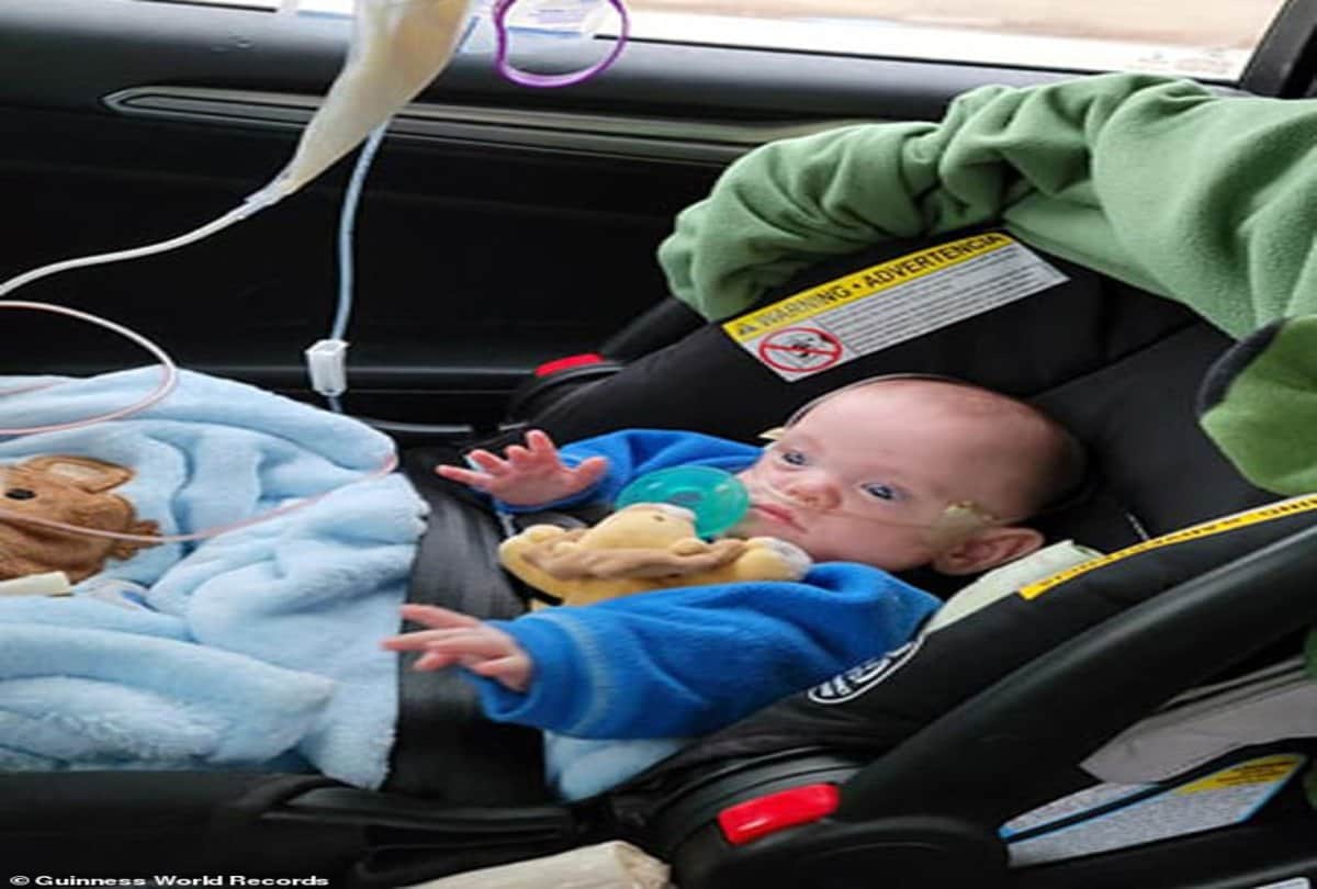 worlds most premature baby fights all odds to celebrate his first birthday