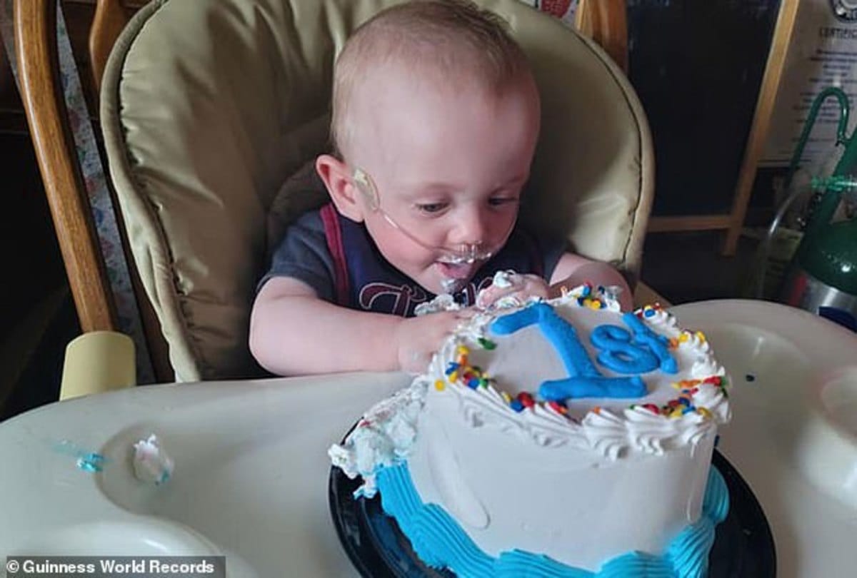 worlds most premature baby fights all odds to celebrate his first birthday