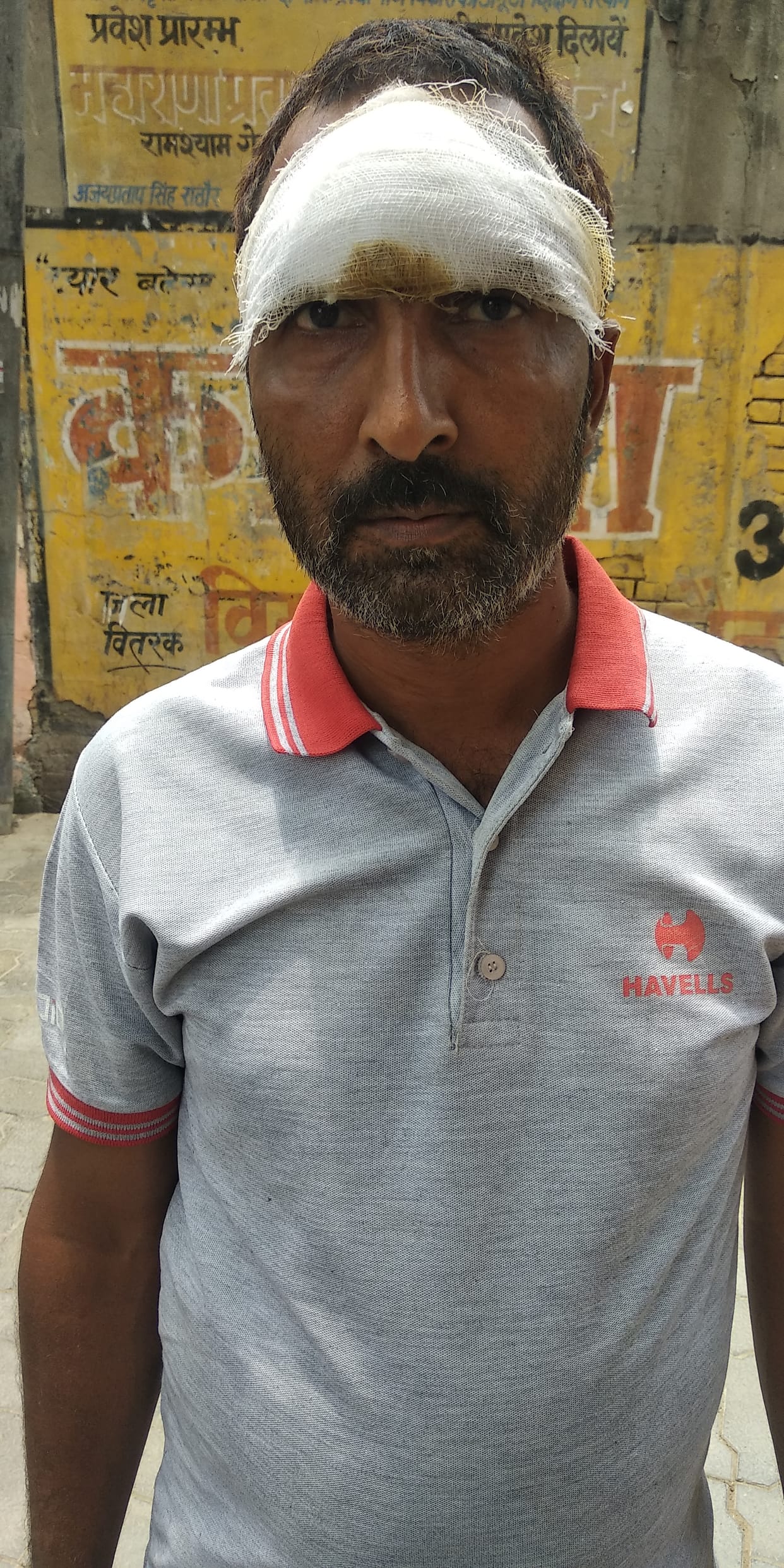 etawah news,villegers,troubled,rogue monkey,one bitten