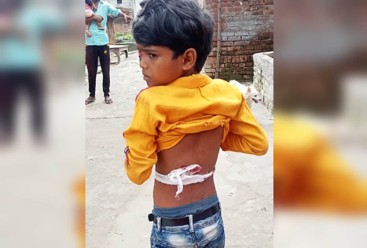 Five injured including brother and sister shot in Harsh firing sant kabir nagar