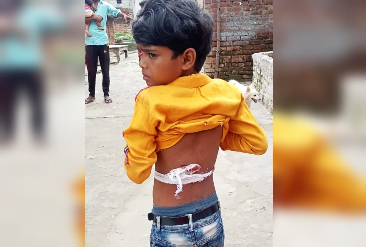 Five injured including brother and sister shot in Harsh firing sant kabir nagar
