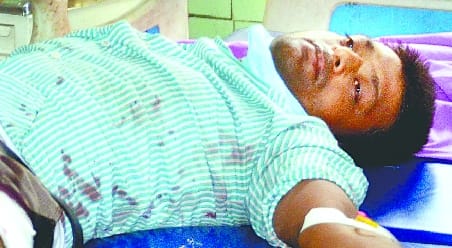 The guard had shot from close range, the thigh bone was broken from seven places.