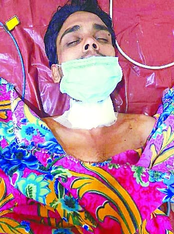 Bareilly: Now the neck was cut by the manjha on the fort bridge