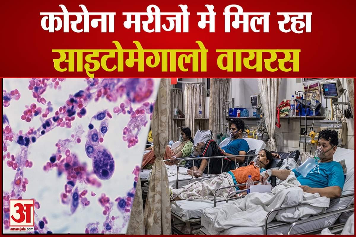 साइटोमेगालो वायरस