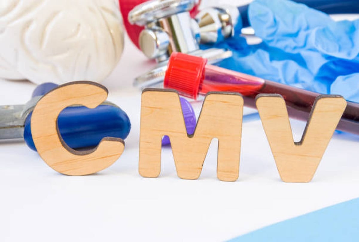 New virus found in Covid patients named Cytomegalovirus symptoms CMV infection