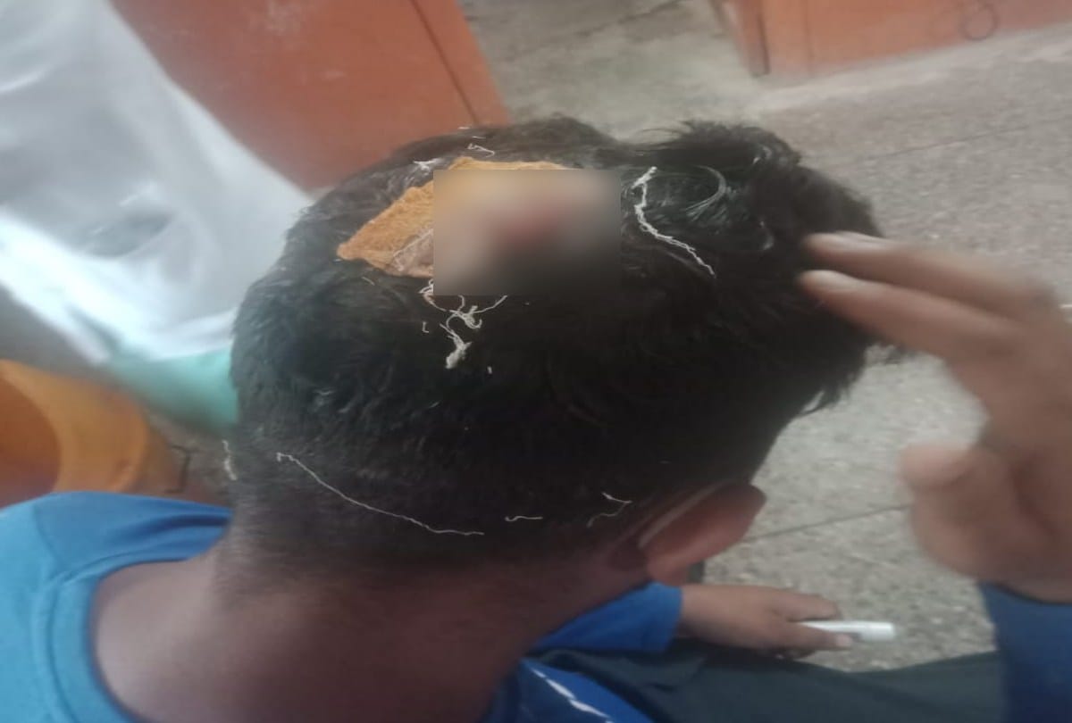A young man going home was attacked with a sharp weapon, seven stitches on his head