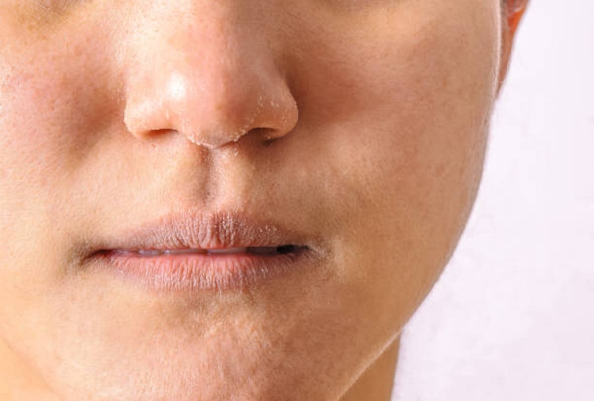Excessive Thirst or always feeling thirsty is a symptom of these five diseases