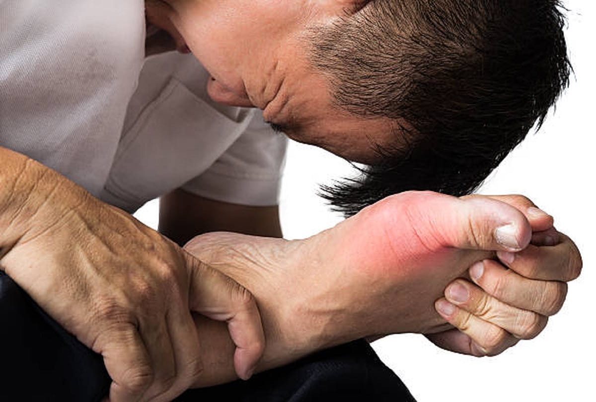 Signs and symptoms of gout disease caused by increased uric acid in the body