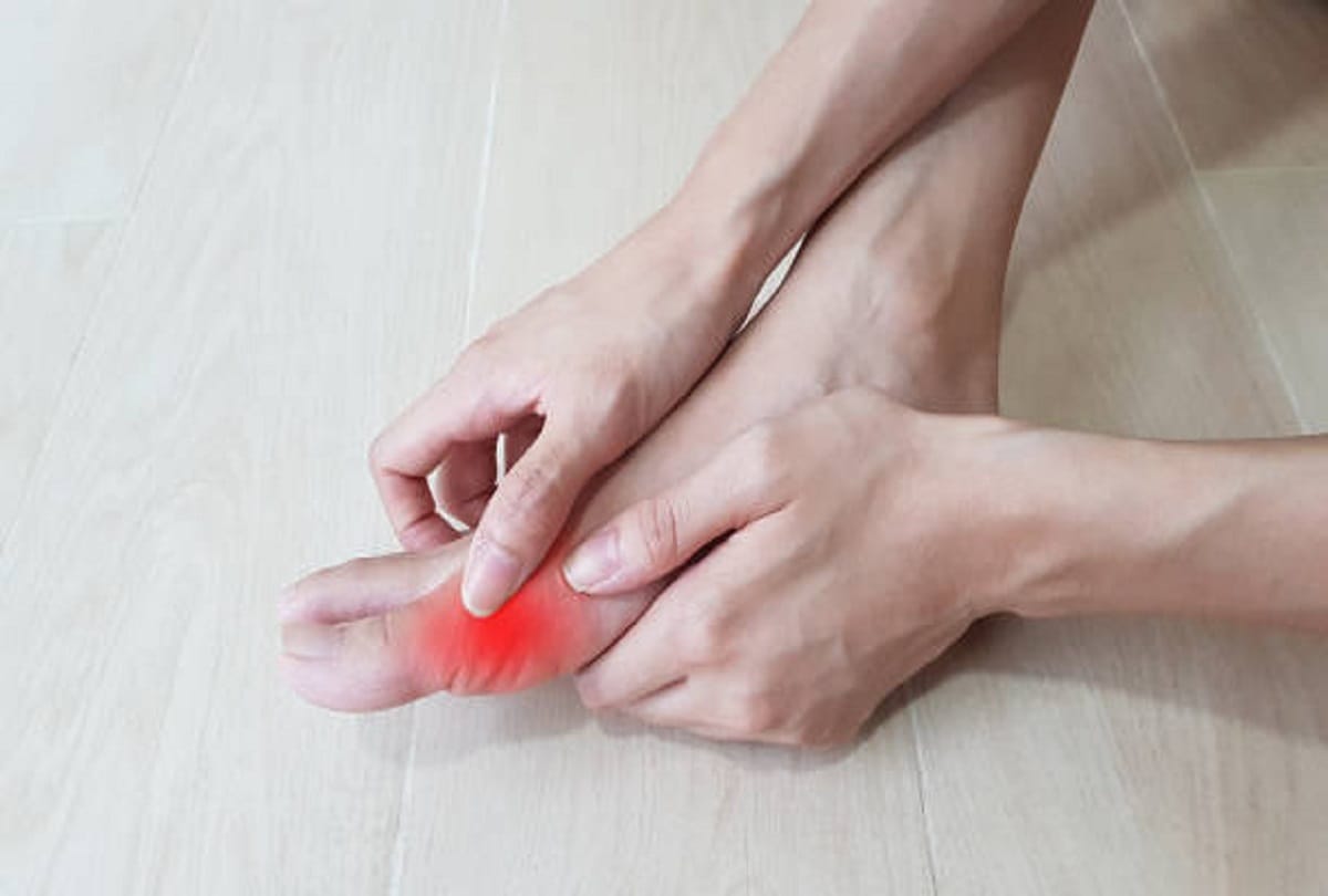 Signs and symptoms of gout disease caused by increased uric acid in the body
