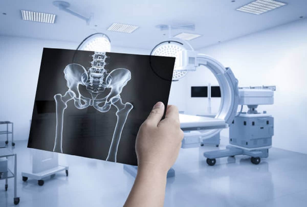 People who got rid of Corona risk of bone death