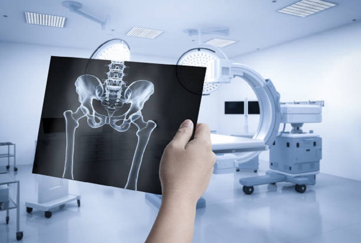 Avascular necrosis or death of bone tissues cases reported after Covid 19 recovered patients