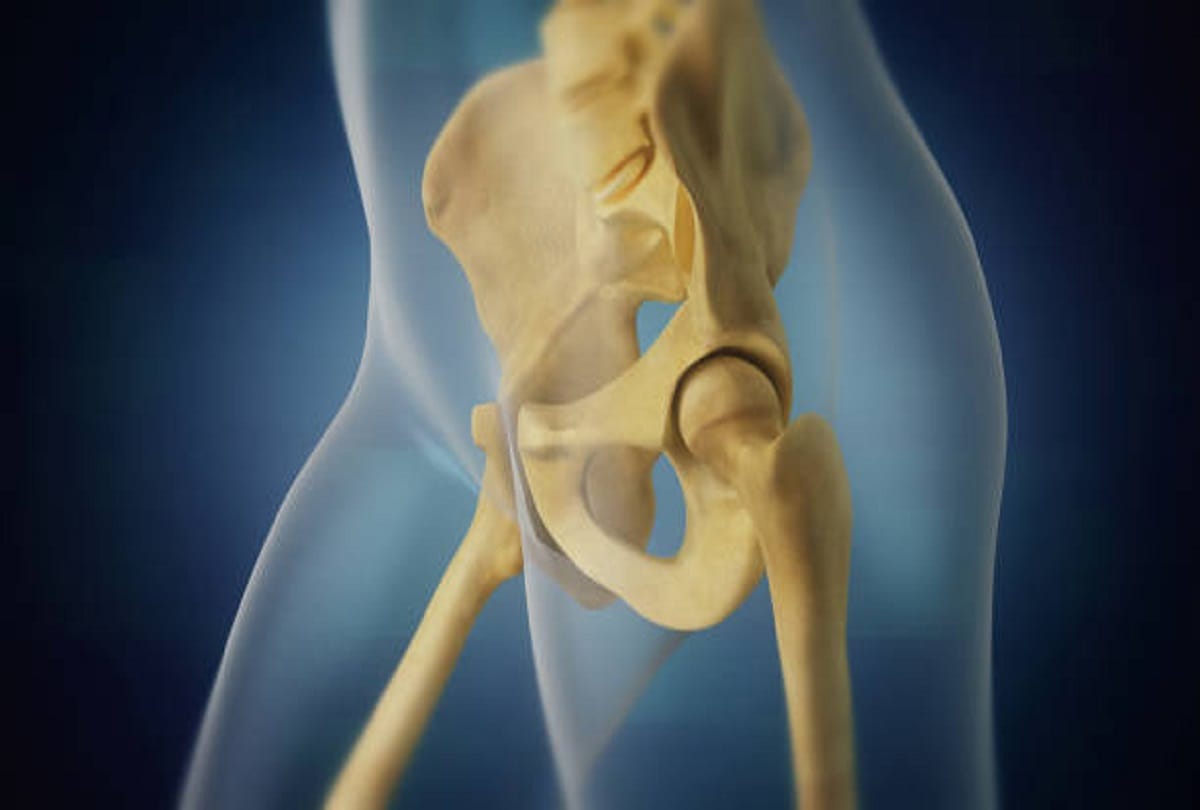 Avascular necrosis or death of bone tissues cases reported after Covid 19 recovered patients