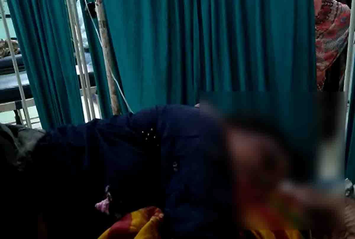 After love marriage, girl was burnt and thrown in jalaun