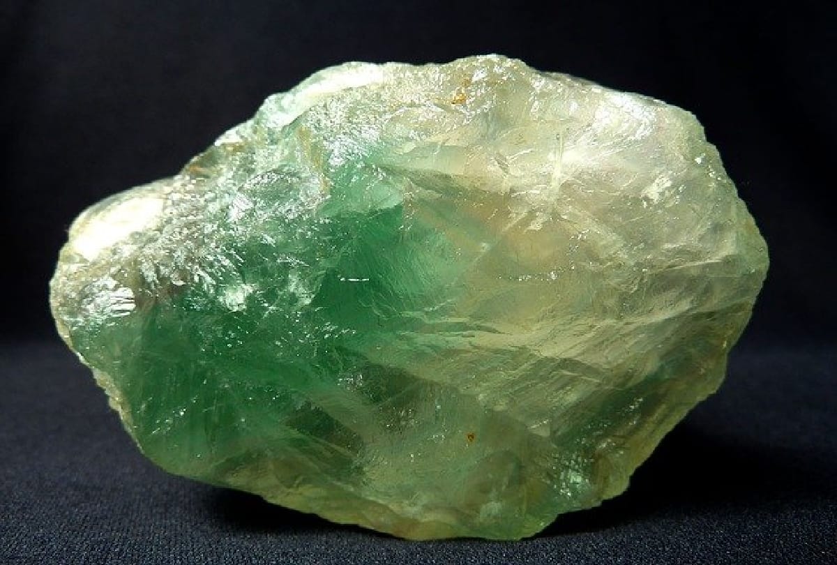 After Surgery Mumbai Doctor removes 1 kilogram calcium oxalate stone from boy urinary bladder