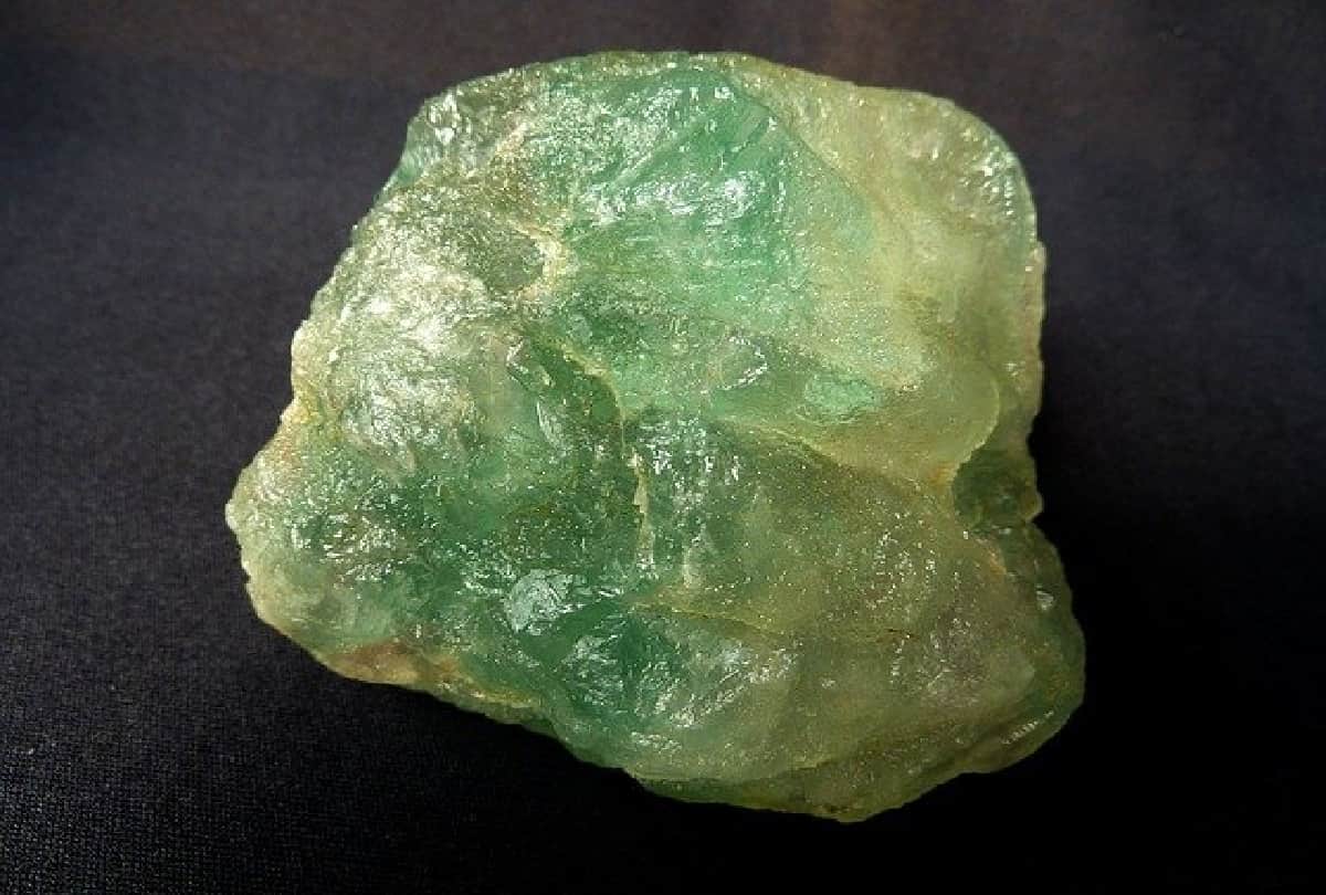 After Surgery Mumbai Doctor removes 1 kilogram calcium oxalate stone from boy urinary bladder