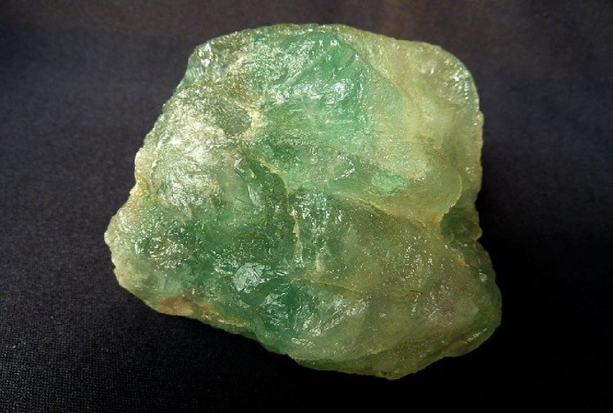 After Surgery Mumbai Doctor removes 1 kilogram calcium oxalate stone from boy urinary bladder