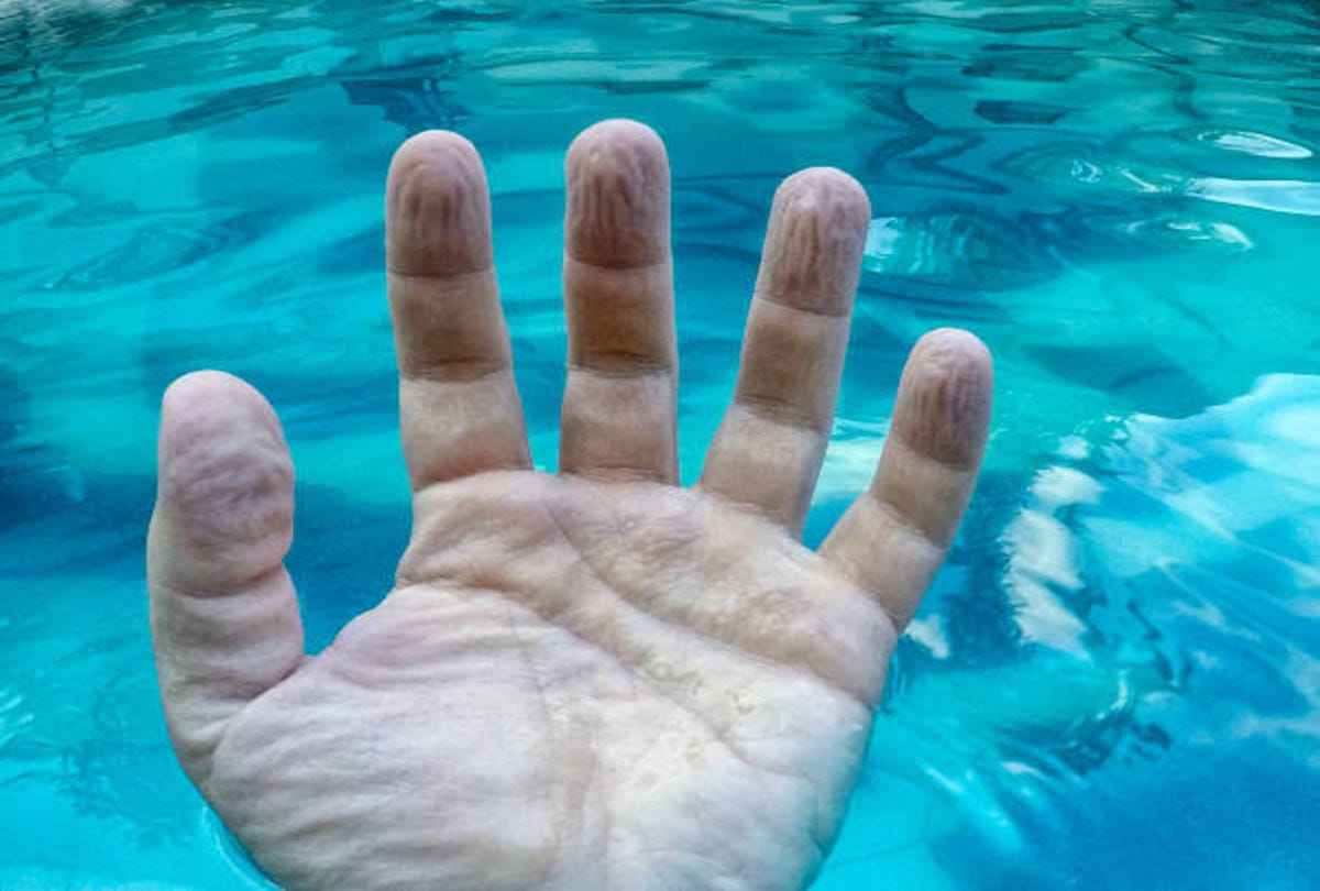 why does finger skin shrink in water