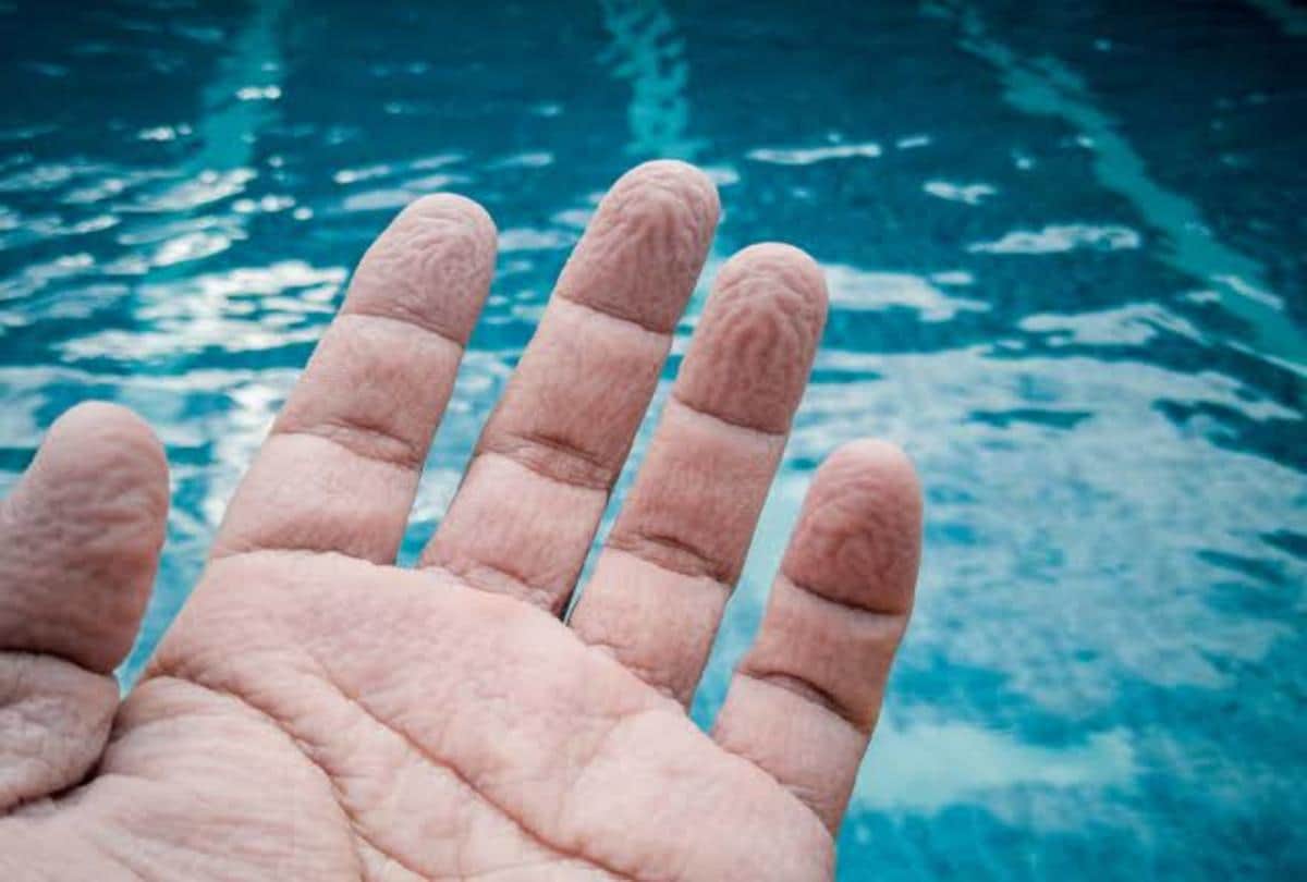 why does finger skin shrink in water