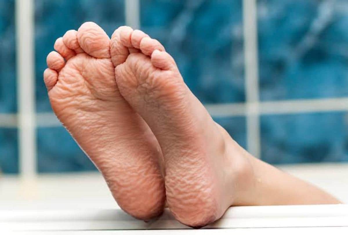 why does finger skin shrink in water