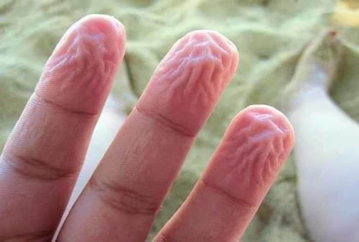 why does finger skin shrink in water