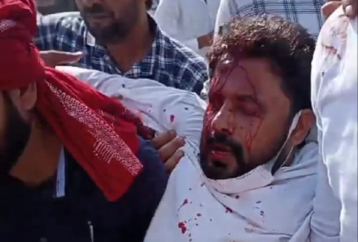 Sikandararau block chief samajwadi party candidate sudama devi son bunty shot by goons