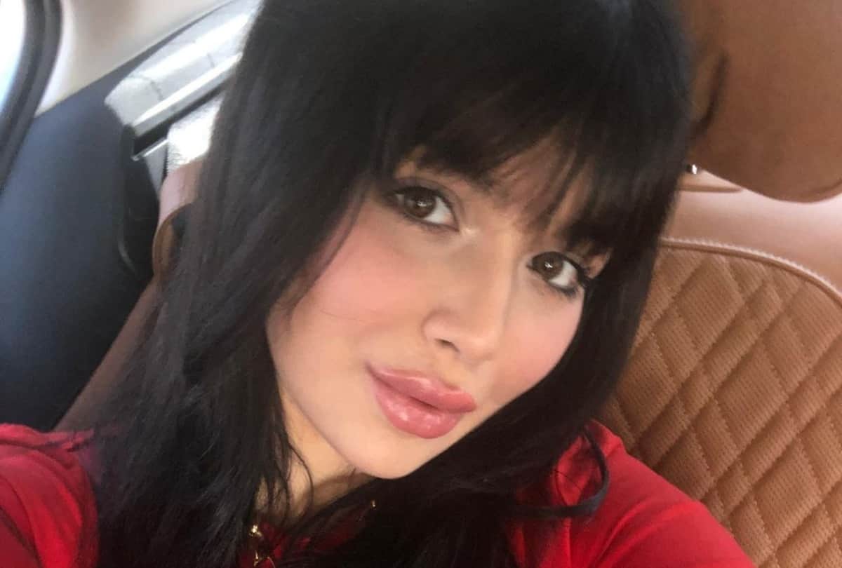 Ayesha Takia Trolled on social media for her lip surgery know details