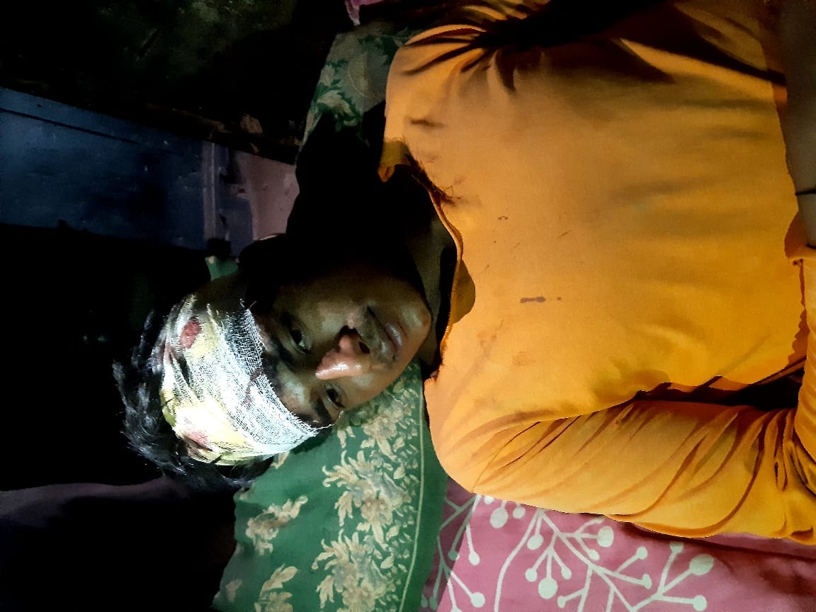 Three injured due to falling roof of kutcha house