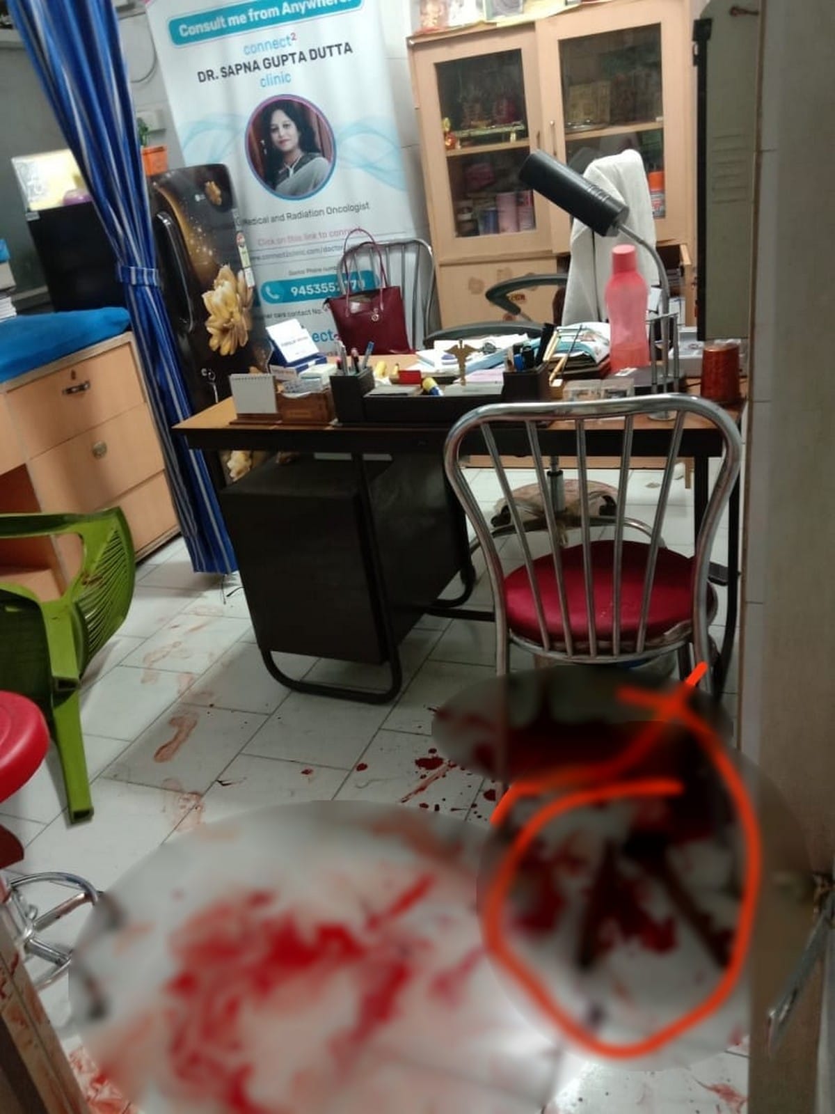 varanasi lady doctor murder: devar killed bhabhi in property dispute case