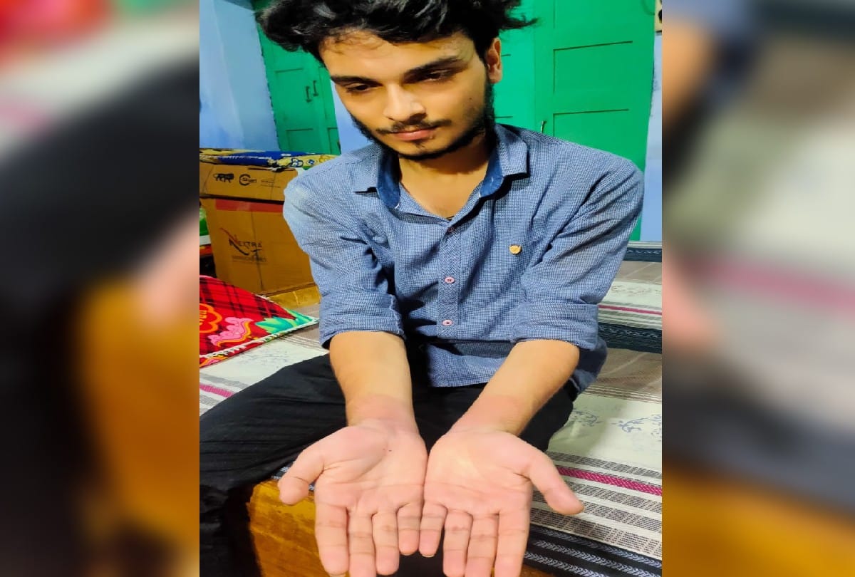 Agra Silver Businessman Gave Third Degree To Young man