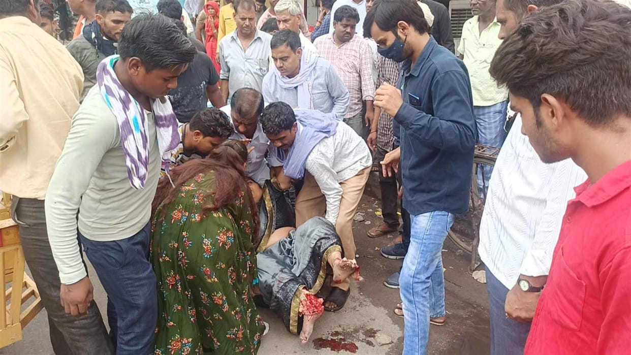 Hathras: Woman's feet crushed after being hit by bus