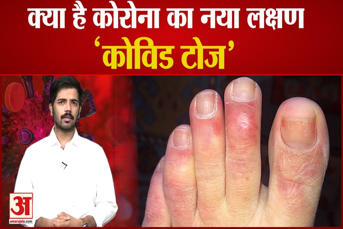 कोविड टोज