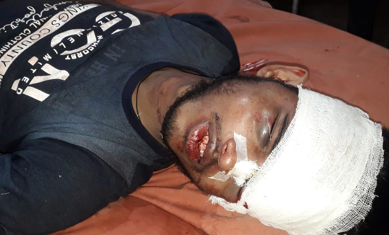 Bike rider dies due to pickup, two injured