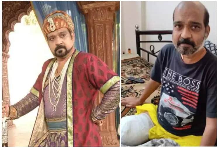 Jodha Akbar Fame Lokendra Singh Rajawat amputated his leg due to high diabetes