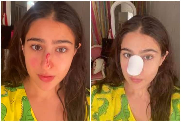 Sara Ali Khan suffers an injury says Naak kaat di maine to Saif Ali Khan and Amrita Singh