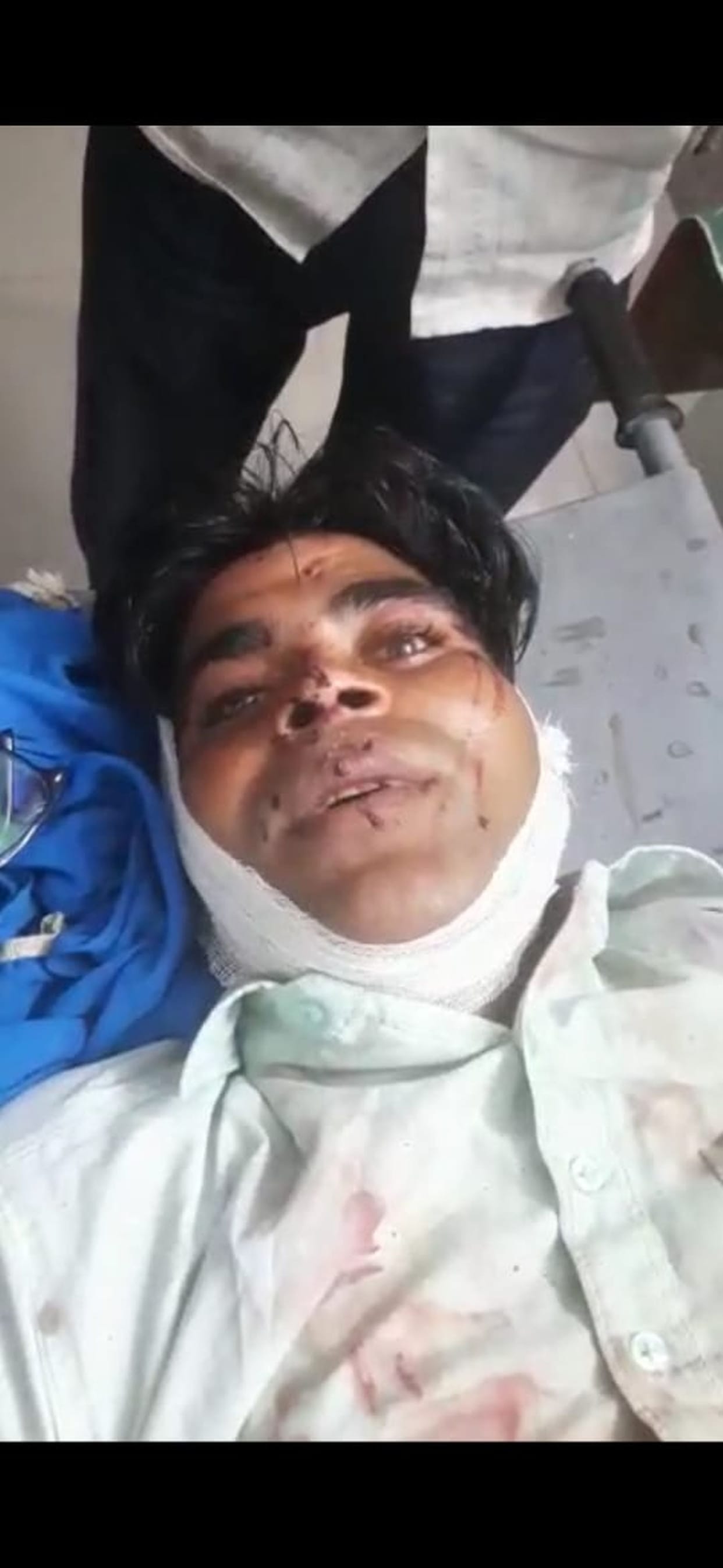 A man has brutally torchered by his friend