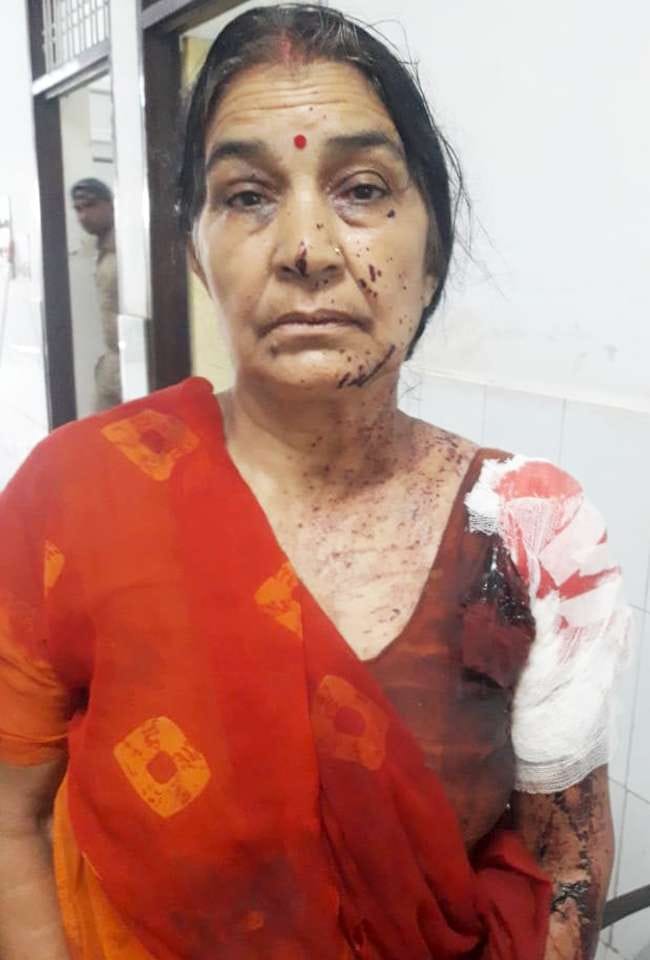 The miscreant opened fire, two injured